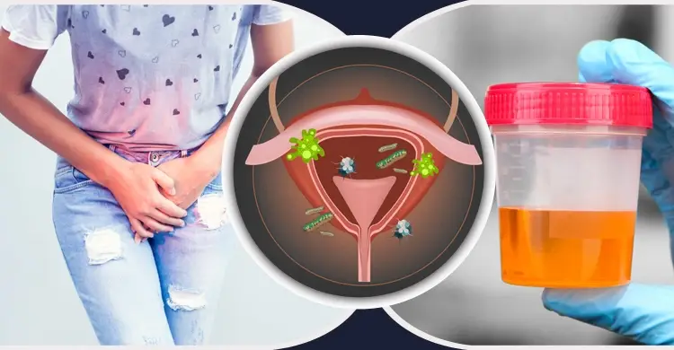 প্রসাবে ইনফেকশন